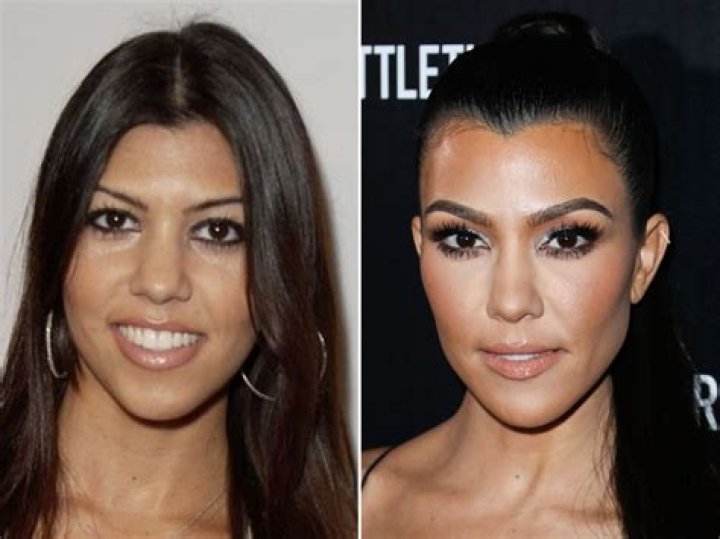 Kourtney Kardashian before and after