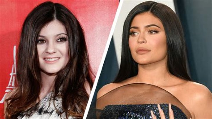 Kylie Jenner before and after